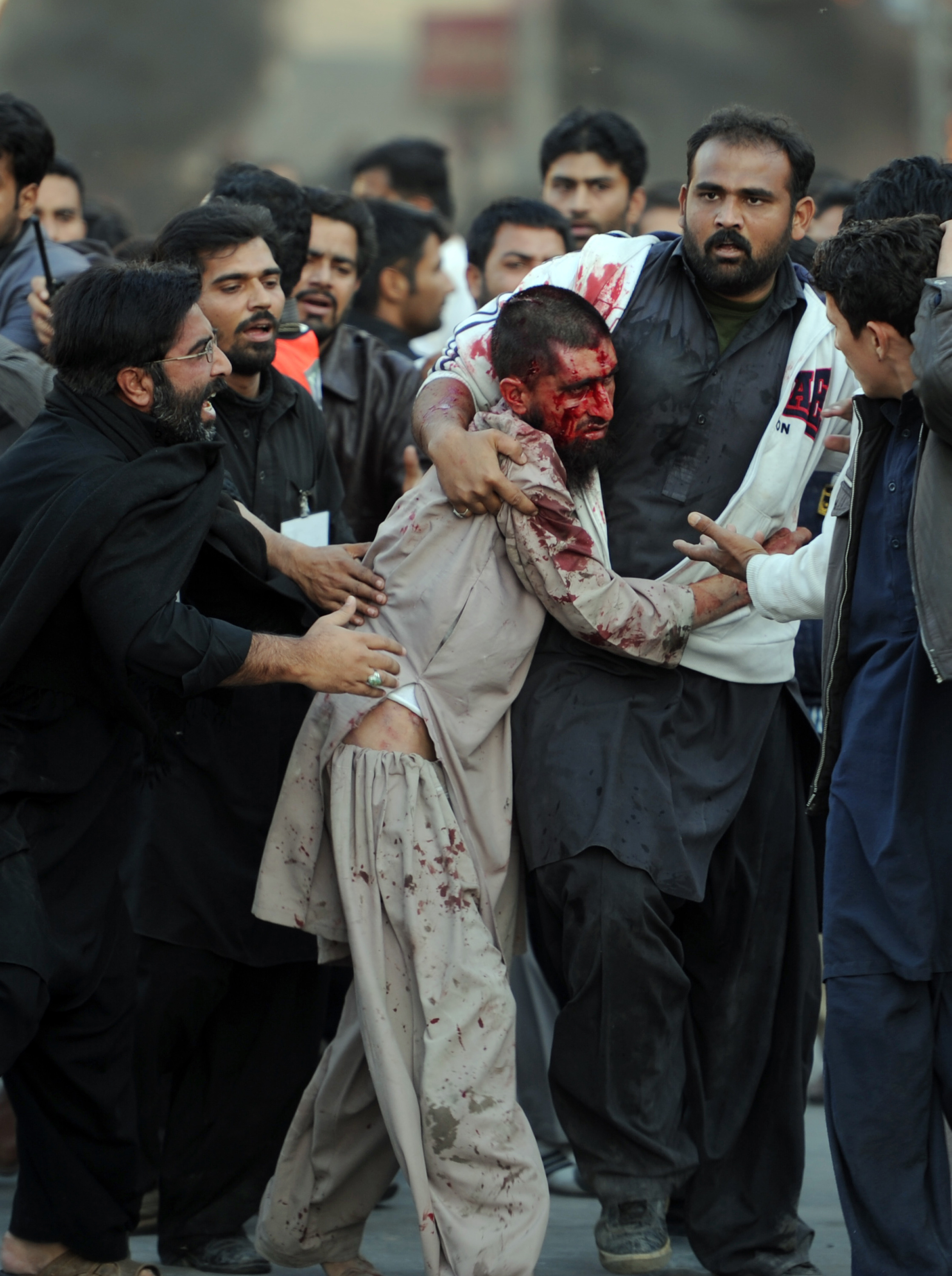 Pakistani Shiite Muslims assist an injured Sunni Muslim following clashes during an Ashura procession in Rawalpindi on November 15, 2013. Sectarian clashes in Pakistan's garrison city Rawalpindi left two people dead and over 20 injured as worshippers massed to mourn the seventh century martyrdom of Hussain, the grandson of prophet Mohammad. The clashes erupted in Rawalpindi when a procession by Shiite Muslims was underway in the main downtown area and a prayer sermon in a nearby Sunni Muslim mosque started at the same time. AFP PHOTO/Aamir QURESHI