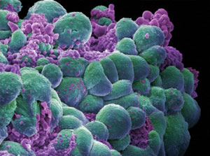 BreastCancerCells